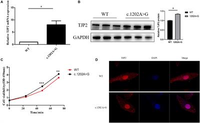 Two Novel Pathogenic Variants of TJP2 Gene and the Underlying Molecular Mechanisms in Progressive Familial Intrahepatic Cholestasis Type 4 Patients